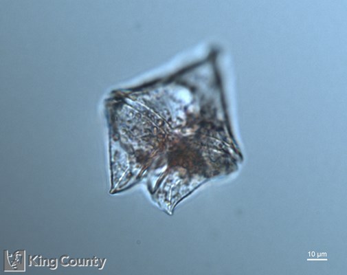 Photo of Protoperidinium conicum/Protoperidinium leonis